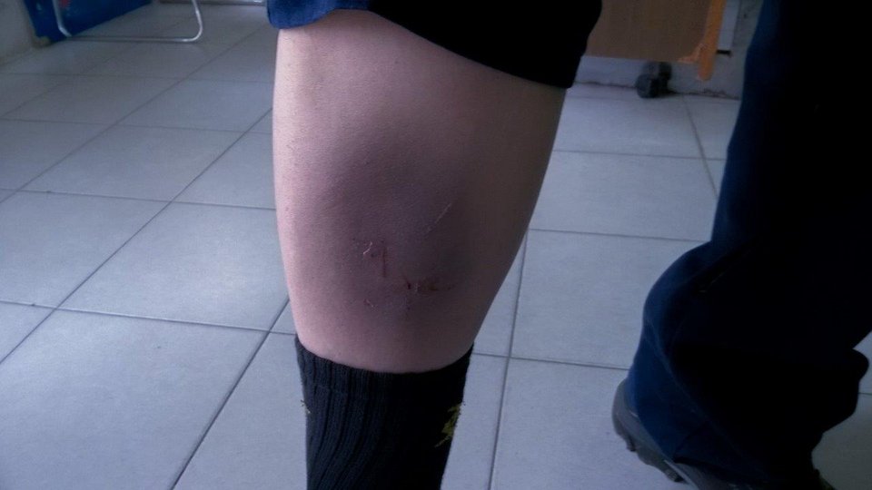 Ενταση και επεισόδια στις Σκουριές -Τραυματισμοί και σπασμένα αυτοκίνητα [εικόνες & βίντεο] | iefimerida.gr 3