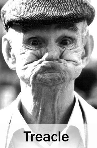 Τα πιο ακομπλεξάριστα, απόκοσμα άσχημα μοντέλα κάνουν καριέρα στο Χόλιγουντ και στα μεγαλύτερα έντυπα μόδας [εικόνες & βίντεο] | iefimerida.gr 6