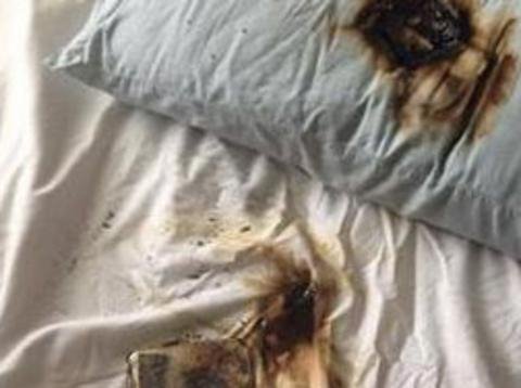 Εφηβη στο Τέξας κοιμόταν και το κινητό της εξερράγη κάτω από το μαξιλάρι της [βίντεο &εικόνες] | iefimerida.gr 2