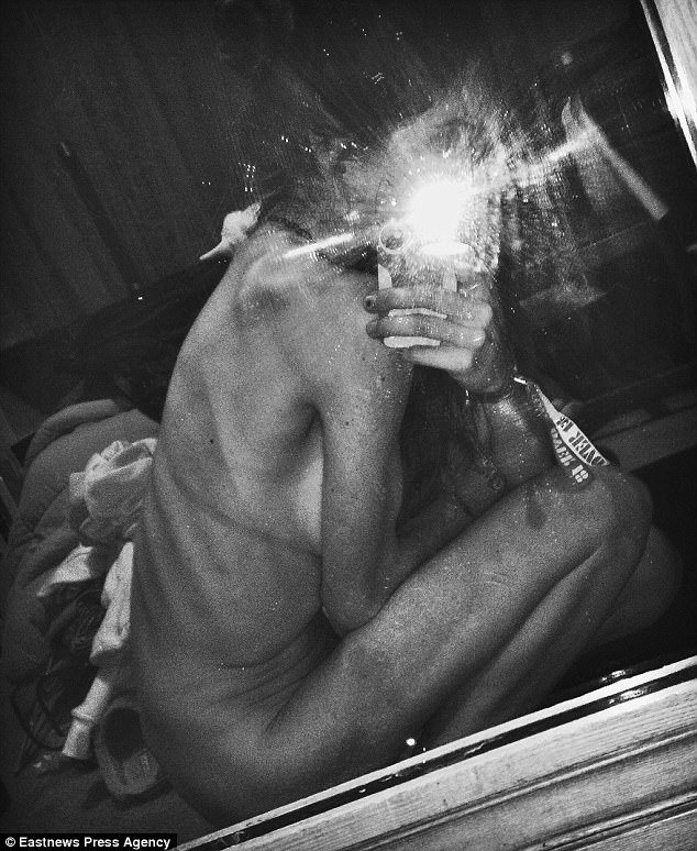 Η απίστευτη μεταμόρφωση ανορεξικής φοιτήτριας -Ηταν σκελετός, τώρα φουσκωμένη από τα βάρη [εικόνες] | iefimerida.gr 1