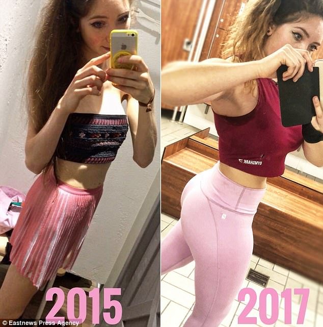 Η απίστευτη μεταμόρφωση ανορεξικής φοιτήτριας -Ηταν σκελετός, τώρα φουσκωμένη από τα βάρη [εικόνες] | iefimerida.gr 6