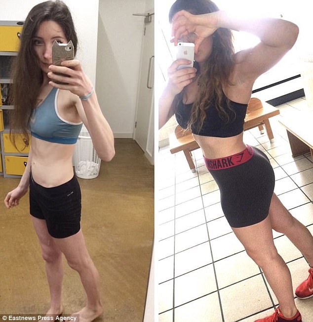 Η απίστευτη μεταμόρφωση ανορεξικής φοιτήτριας -Ηταν σκελετός, τώρα φουσκωμένη από τα βάρη [εικόνες] | iefimerida.gr 4