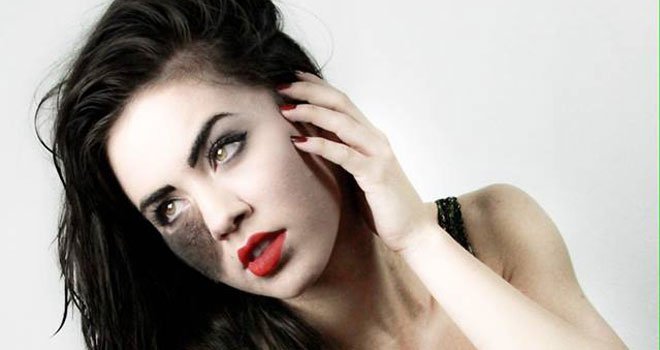 Πώς μια καλλονή με τριχωτό σημάδι εκ γενετής αγάπησε την ιδιαιτερότητά της και έγινε χορεύτρια [εικόνες]  | iefimerida.gr 5