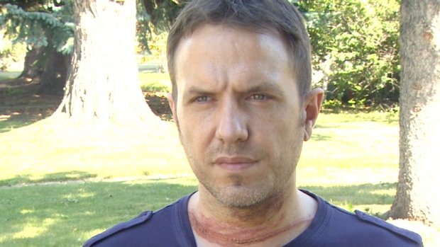 Ελληνο-Καναδός παριστάνει ότι κόπηκε ο λαιμός του και κάνει έρανο μέσω ίντερνετ [εικόνες] | iefimerida.gr 3