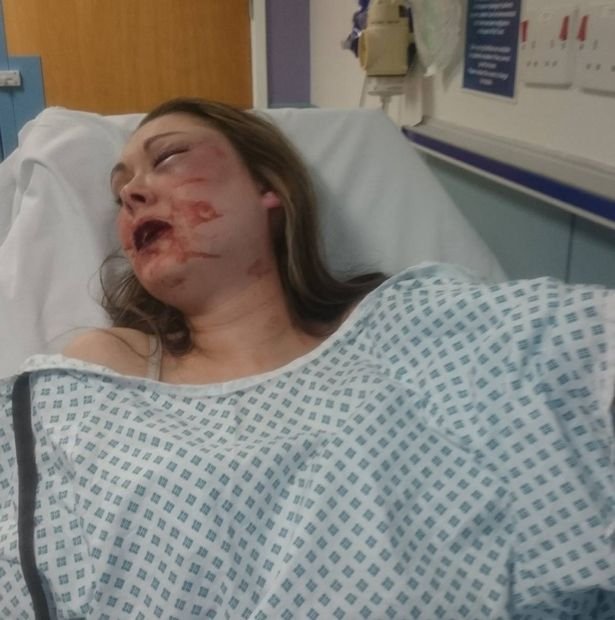 Της έσπασε το σαγόνι και τρία δόντια επειδή δεν ήθελε σεξ μαζί του [σκληρές εικόνες] | iefimerida.gr 3