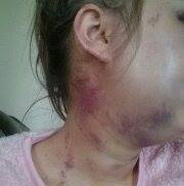 Της έσπασε το σαγόνι και τρία δόντια επειδή δεν ήθελε σεξ μαζί του [σκληρές εικόνες] | iefimerida.gr 7