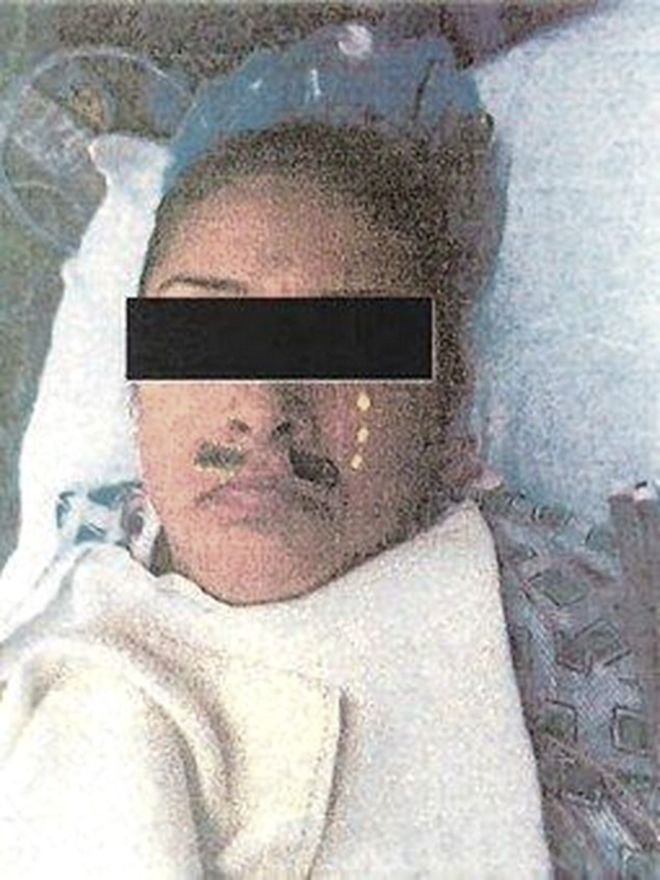 Κάφροι γιατροί ζωγράφισαν μουστάκι σε ασθενή την ώρα της επέμβασης- Τους έκανε μήνυση όταν είδε τη φωτογραφία στο ίντερνετ [εικόνα]  | iefimerida.gr 0