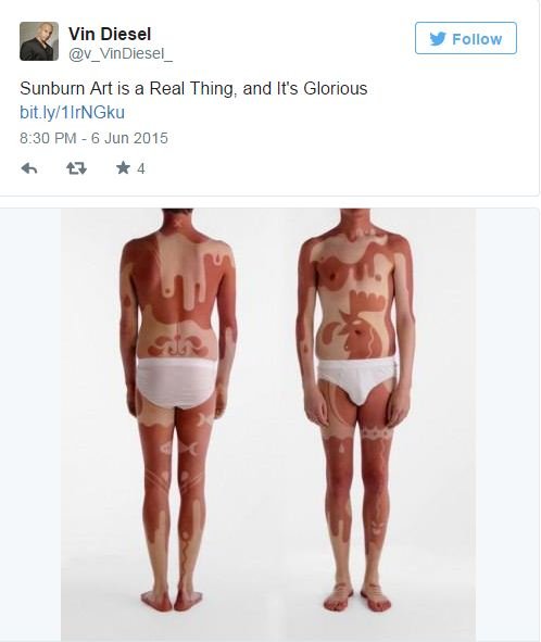 Η νέα επικίνδυνη μόδα: Κάθονται στο ήλιο για να κάνουν εγκαύματα με σχέδια [εικόνες] | iefimerida.gr 4