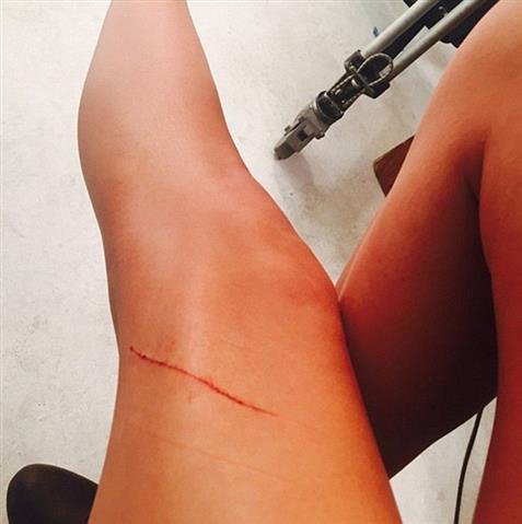 Της πλήγωσαν τα πόδια που αξίζουν 40 εκατ. δολάρια! [εικόνες] | iefimerida.gr 0