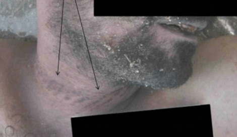 Ηλεκτροσόκ στραγγαλισμοί, εκτελέσεις: Φρικτές εικόνες από εγκλήματα ανδρών του Ασαντ [εικόνες&βίντεο] | iefimerida.gr 2