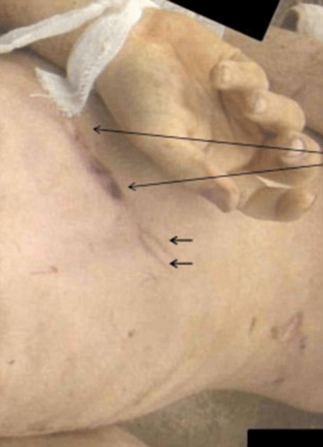 Ηλεκτροσόκ στραγγαλισμοί, εκτελέσεις: Φρικτές εικόνες από εγκλήματα ανδρών του Ασαντ [εικόνες&βίντεο] | iefimerida.gr 3