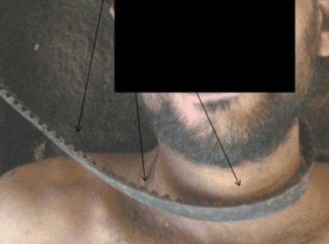 Ηλεκτροσόκ στραγγαλισμοί, εκτελέσεις: Φρικτές εικόνες από εγκλήματα ανδρών του Ασαντ [εικόνες&βίντεο] | iefimerida.gr 0