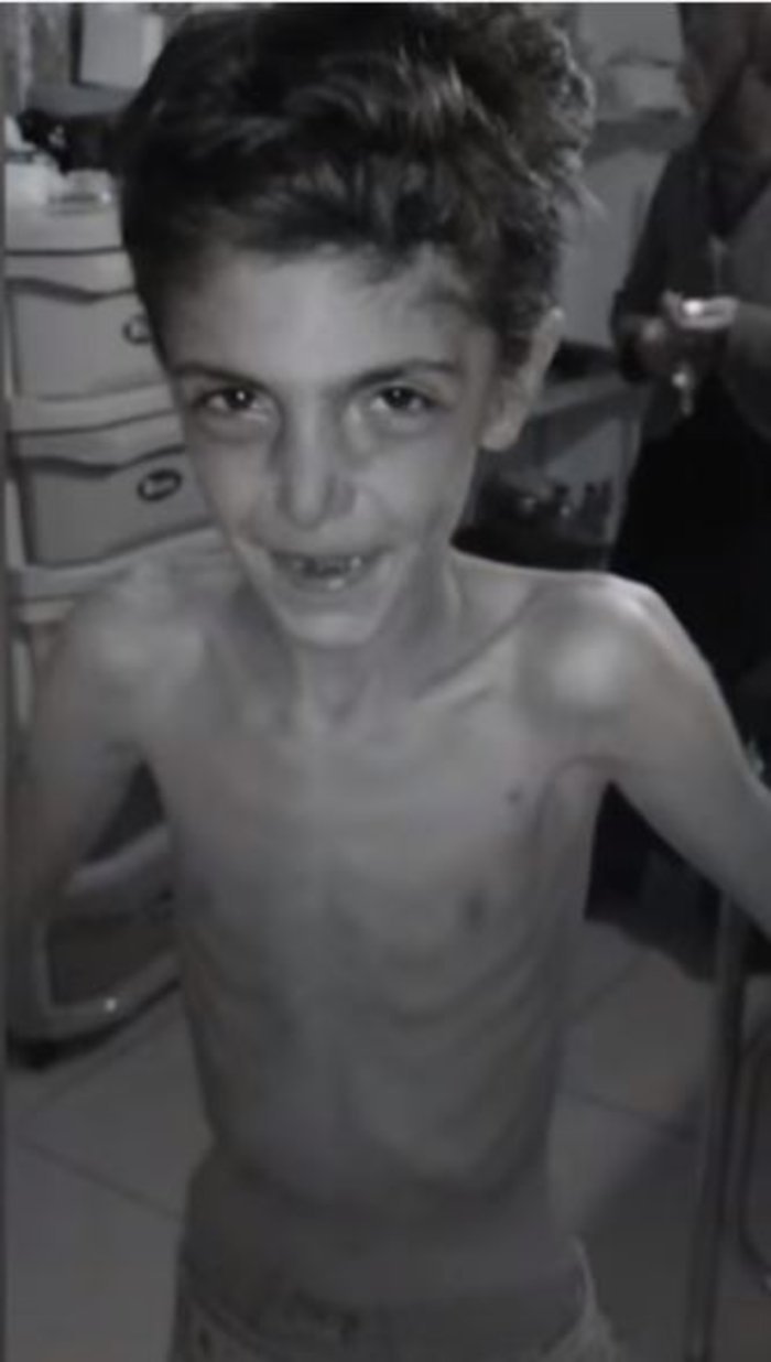 Η πόλη των «ζωντανών-νεκρών» στη Συρία -Μοντάγια, εκεί που άνθρωποι τρώνε χώμα, γρασίδι και κατοικίδια [εικόνες] | iefimerida.gr 1