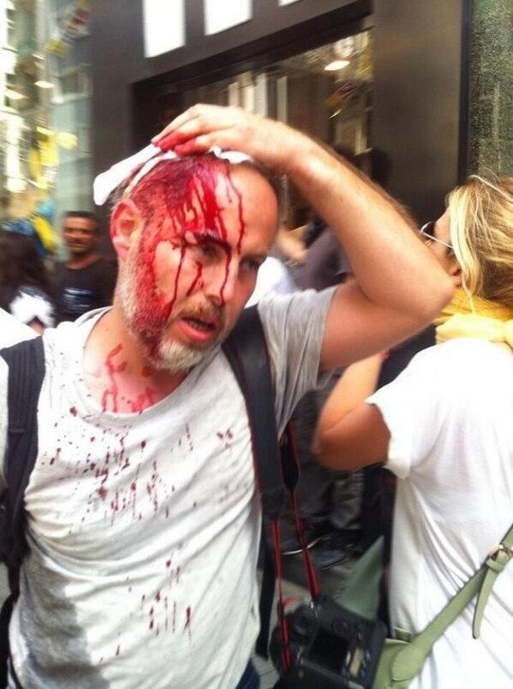 Σοκ από την ωμή βία εναντίον των Τούρκων διαδηλωτών [εικόνες] | iefimerida.gr 2