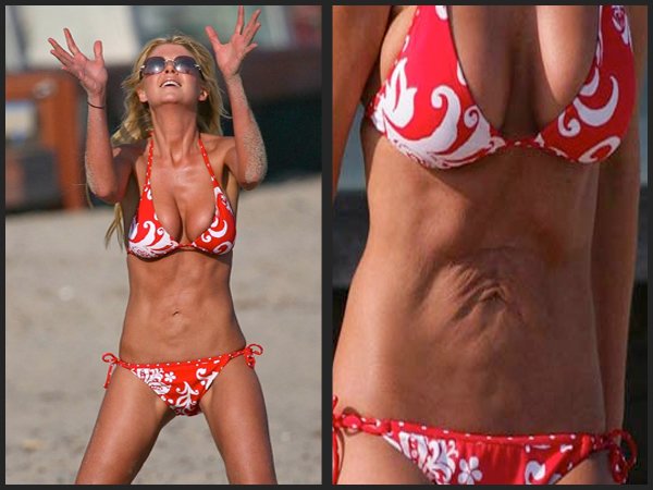 Σοκαριστικές εμφανίσεις διάσημων με μαγιό [εικόνες] | iefimerida.gr 4