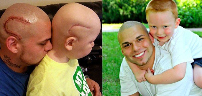 Συγκλονίζει ο πατέρας: Χτύπησε τατουάζ την πληγή του γιού του στο κεφάλι [εικόνες] | iefimerida.gr 0