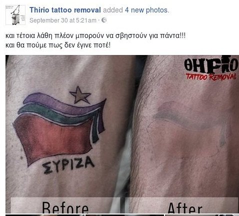 Είχε χτυπήσει τατουάζ... ΣΥΡΙΖΑ – Πήγε και το αφαίρεσε [εικόνες] | iefimerida.gr 0