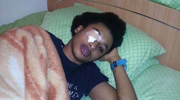 Καλλιτέχνες αυτοτυφλώνονται κάνοντας τατουάζ στα μάτια -Ανατριχιαστικές εικόνες  | iefimerida.gr 1