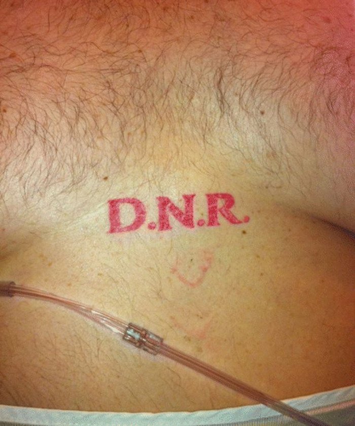 Ασθενής με τατουάζ «Μη ανάνηψης» προκαλεί πανικό σε γιατρούς νοσοκομείου [εικόνα] | iefimerida.gr 0