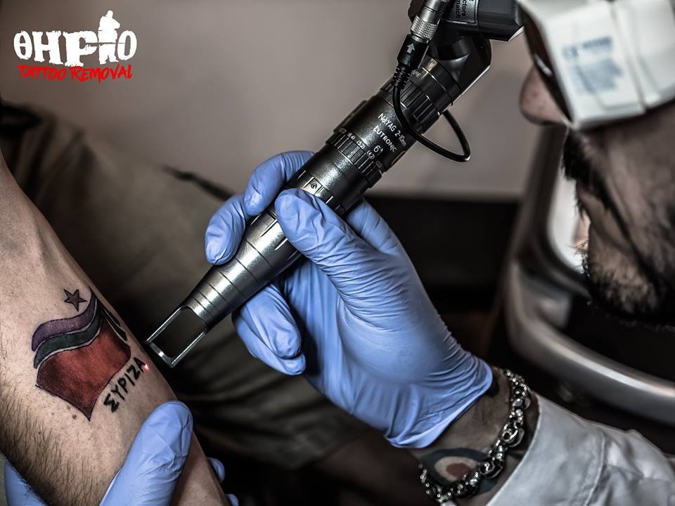 Είχε χτυπήσει τατουάζ... ΣΥΡΙΖΑ – Πήγε και το αφαίρεσε [εικόνες] | iefimerida.gr 3