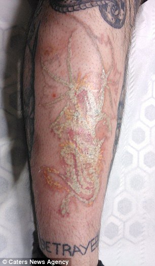 Κολλημένος με τα τατουάζ -Κάλυψε όλο του το κορμί και τώρα τα αφαιρεί με λέιζερ για να ξεκινήσει από την αρχή [εικόνες] | iefimerida.gr 1