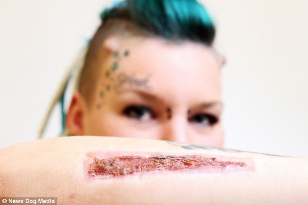 Φρίκη: Εγδαρε από το δέρμα της το τατουάζ με το όνομα του πρώην της και του το έστειλε ταχυδρομικώς [εικόνες] | iefimerida.gr 0