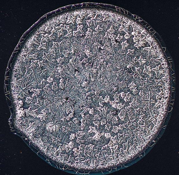 Ετσι μοιάζουν τα δάκρυα στο μικροσκόπιο [εικόνες] | iefimerida.gr 2