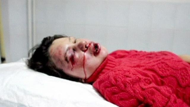 Ουκρανία: Δημοσιογράφος-υπουργός χάνει τον πόλεμο εναντίον της διαφθοράς και παραιτείται [εικόνες] | iefimerida.gr 1