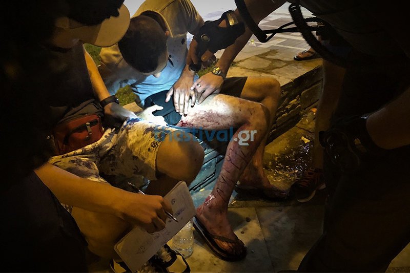 Θεσσαλονίκη: Αιματηρή επίθεση σε μετανάστες στο κέντρο της πόλης -Τέσσερις τραυματίες | iefimerida.gr 0