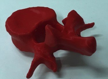 Η χειρουργική κλινική του ΑΠΘ πέτυχε την τρισδιάστατη μοντελοποίηση ανθρώπινων οργάνων [εικόνες] | iefimerida.gr 1