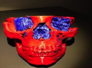 Η χειρουργική κλινική του ΑΠΘ πέτυχε την τρισδιάστατη μοντελοποίηση ανθρώπινων οργάνων [εικόνες] | iefimerida.gr 3