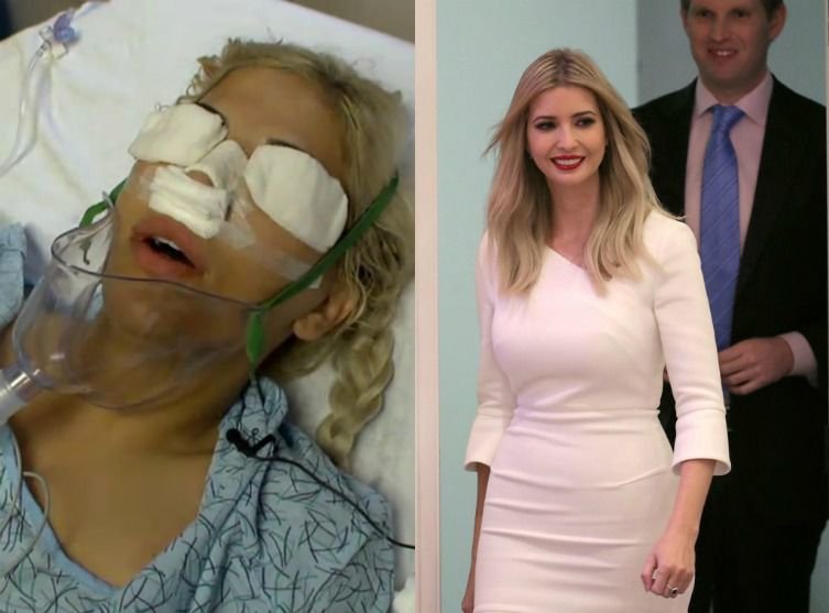 Αμερικανίδες κάνουν τα πάντα για να μοιάζουν με την... Ιβάνκα  Τραμπ-Δίνουν μέχρι και 90.000 δολ. σε πλαστικές [εικόνες] | iefimerida.gr 3