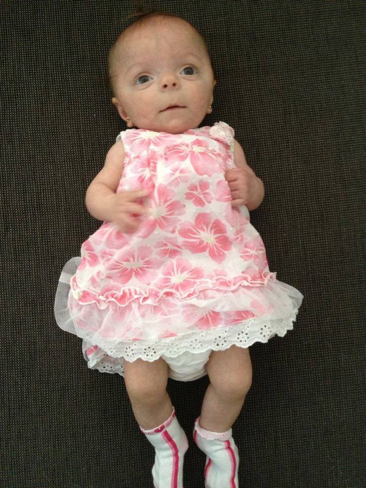 Το πιο μικροσκοπικό κορίτσι -Μικρότερη και από μια κούκλα, τετράχρονη στην Αυστραλία [εικόνες] | iefimerida.gr 0