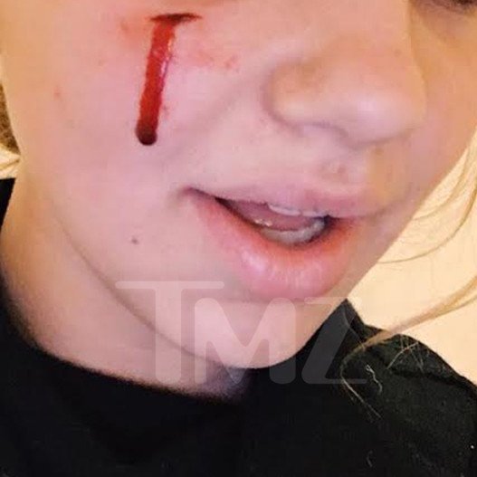 Η σκυλίτσα των Ομπάμα δάγκωσε μια 18χρονη που πήγε να τη χαϊδέψει [εικόνες] | iefimerida.gr 0