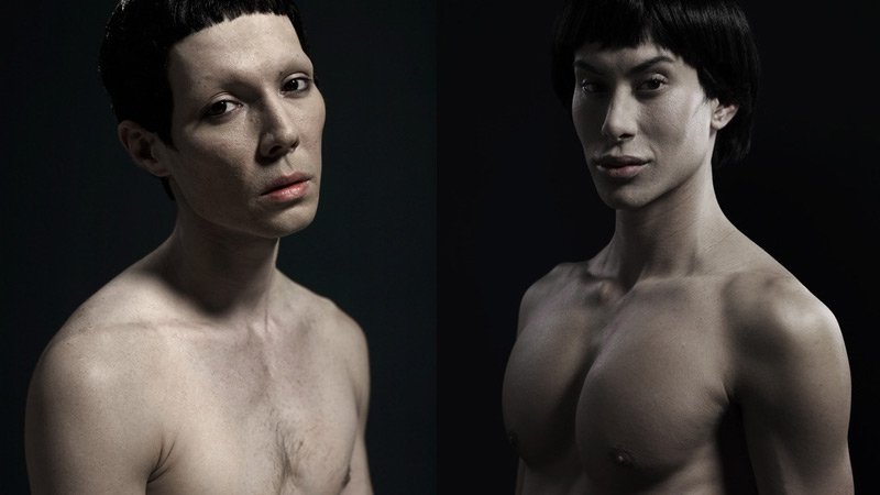 H υπερβολή στο πετσί τους -Ακραίες πλαστικές επεμβάσεις στο φακό του φωτογράφου [εικόνες] | iefimerida.gr 0