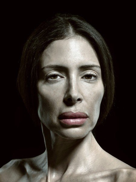 H υπερβολή στο πετσί τους -Ακραίες πλαστικές επεμβάσεις στο φακό του φωτογράφου [εικόνες] | iefimerida.gr 8