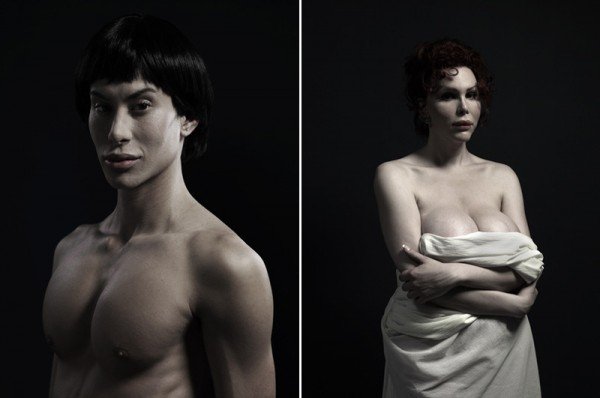 H υπερβολή στο πετσί τους -Ακραίες πλαστικές επεμβάσεις στο φακό του φωτογράφου [εικόνες] | iefimerida.gr 7