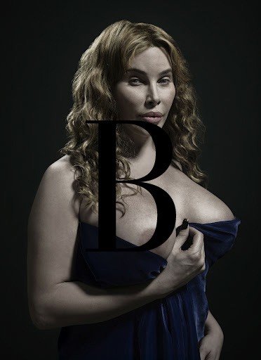 H υπερβολή στο πετσί τους -Ακραίες πλαστικές επεμβάσεις στο φακό του φωτογράφου [εικόνες] | iefimerida.gr 9