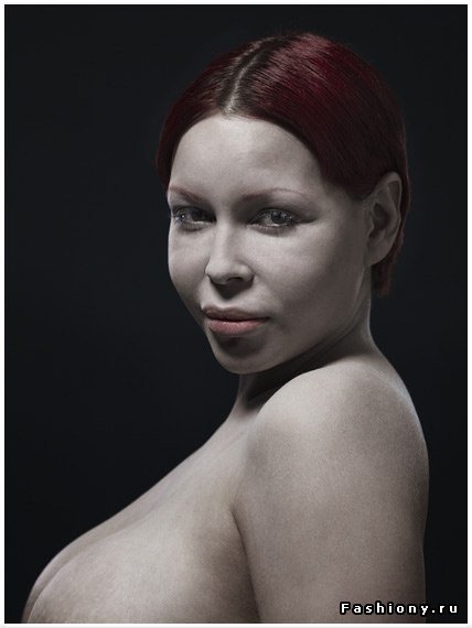 H υπερβολή στο πετσί τους -Ακραίες πλαστικές επεμβάσεις στο φακό του φωτογράφου [εικόνες] | iefimerida.gr 3