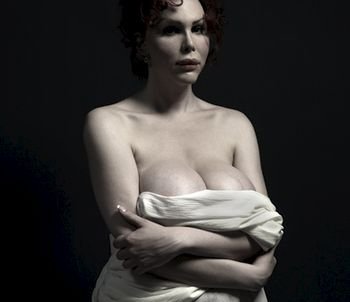 H υπερβολή στο πετσί τους -Ακραίες πλαστικές επεμβάσεις στο φακό του φωτογράφου [εικόνες] | iefimerida.gr 12