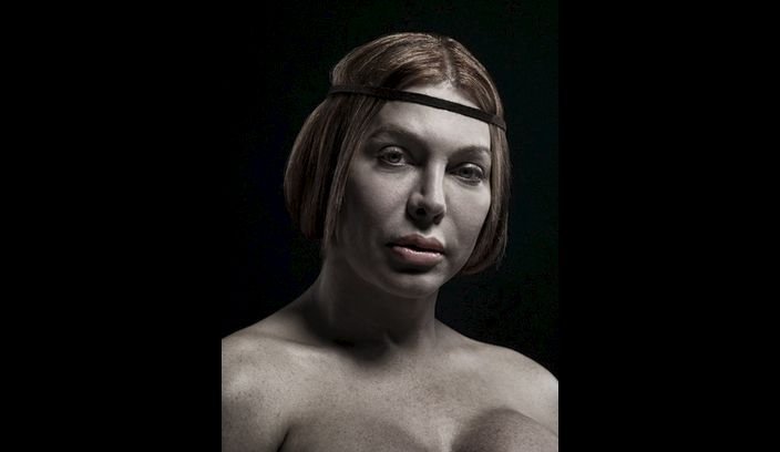 H υπερβολή στο πετσί τους -Ακραίες πλαστικές επεμβάσεις στο φακό του φωτογράφου [εικόνες] | iefimerida.gr 14