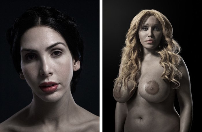 H υπερβολή στο πετσί τους -Ακραίες πλαστικές επεμβάσεις στο φακό του φωτογράφου [εικόνες] | iefimerida.gr 10