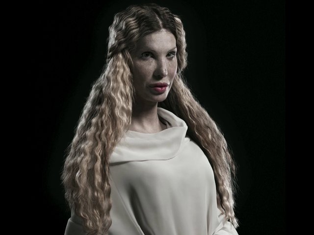 H υπερβολή στο πετσί τους -Ακραίες πλαστικές επεμβάσεις στο φακό του φωτογράφου [εικόνες] | iefimerida.gr 11