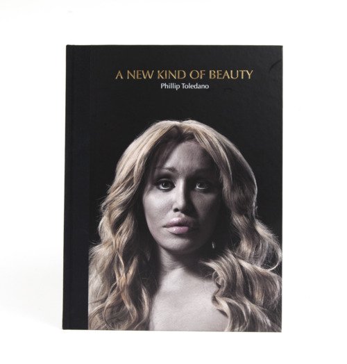 H υπερβολή στο πετσί τους -Ακραίες πλαστικές επεμβάσεις στο φακό του φωτογράφου [εικόνες] | iefimerida.gr 17