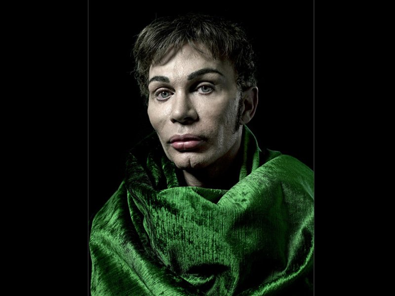 H υπερβολή στο πετσί τους -Ακραίες πλαστικές επεμβάσεις στο φακό του φωτογράφου [εικόνες] | iefimerida.gr 20