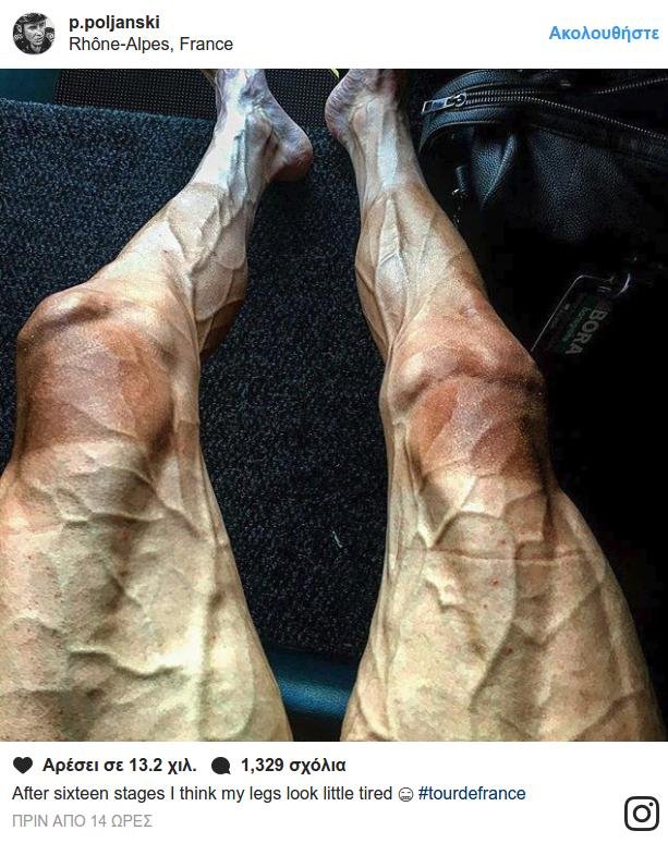 Σοκάρουν τα πόδια ποδηλάτη από τον Γύρο της Γαλλίας [εικόνες] | iefimerida.gr 0