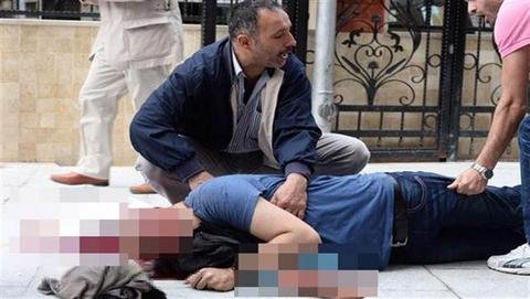 Πεδίο μάχης και πάλι η Κωνσταντινούπολη -Σοκάρει ο βαρύτατος τραυματισμός διαδηλωτή [εικόνες&βίντεο] | iefimerida.gr 1