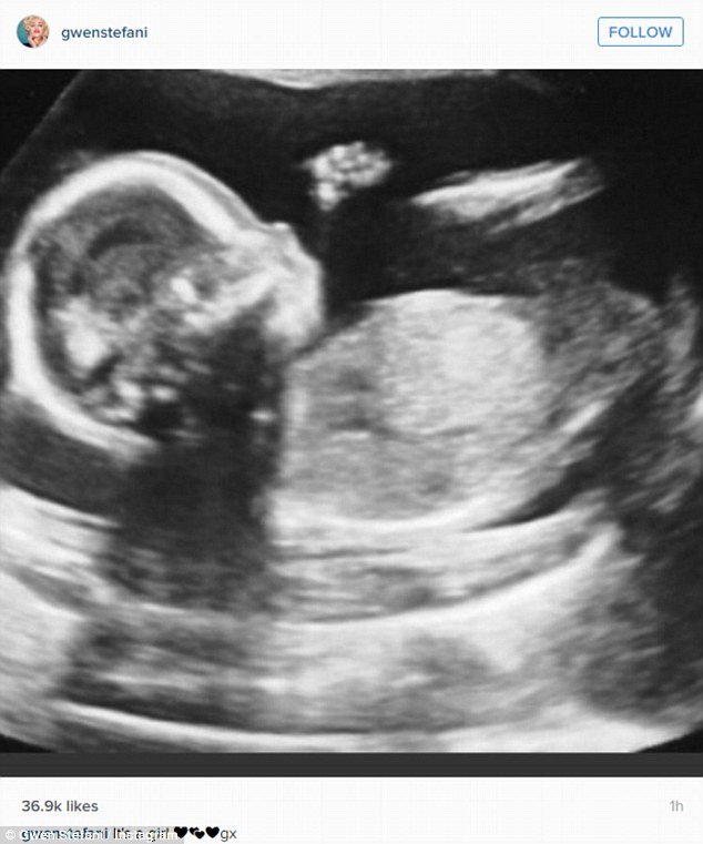 Πρωταπριλιάτικο ψέμα γνωστής τραγουδίστριας ότι ήταν έγκυος -Την έκραξαν οι φανς της [εικόνες] | iefimerida.gr 0