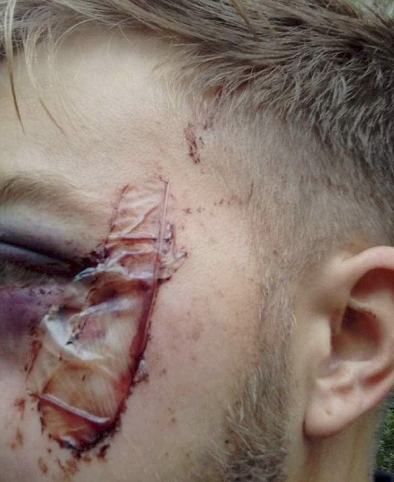 Καταγγελίες σε σελίδα του αντιεξουσιαστικού χώρου για χρήση πλαστικών σφαιρών από τα ΜΑΤ [εικόνες] | iefimerida.gr 2