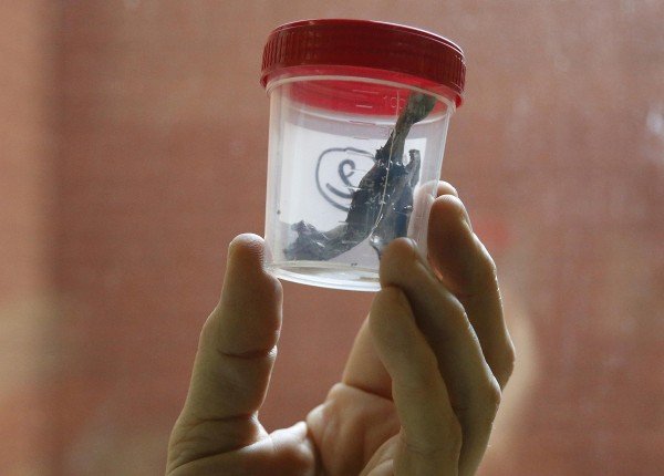 Εβγαλαν βίδες και μεταλλικά θραύσματα από τα θύματα των επιθέσεων στις Βρυξέλλες [εικόνες] | iefimerida.gr 5